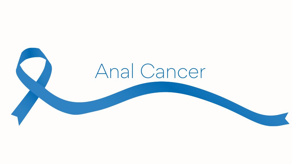 Anal Cancer