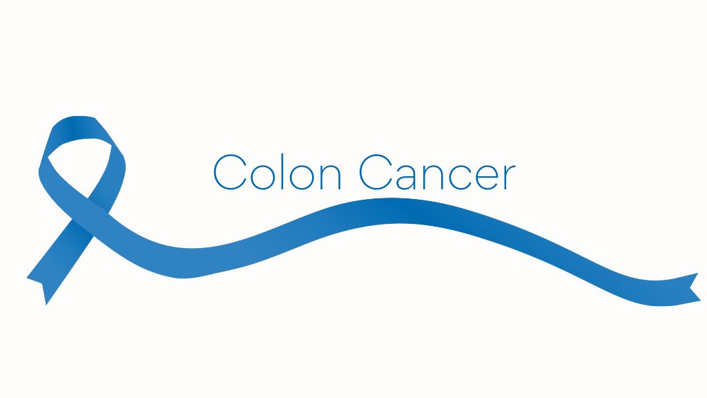 Colon Cancer