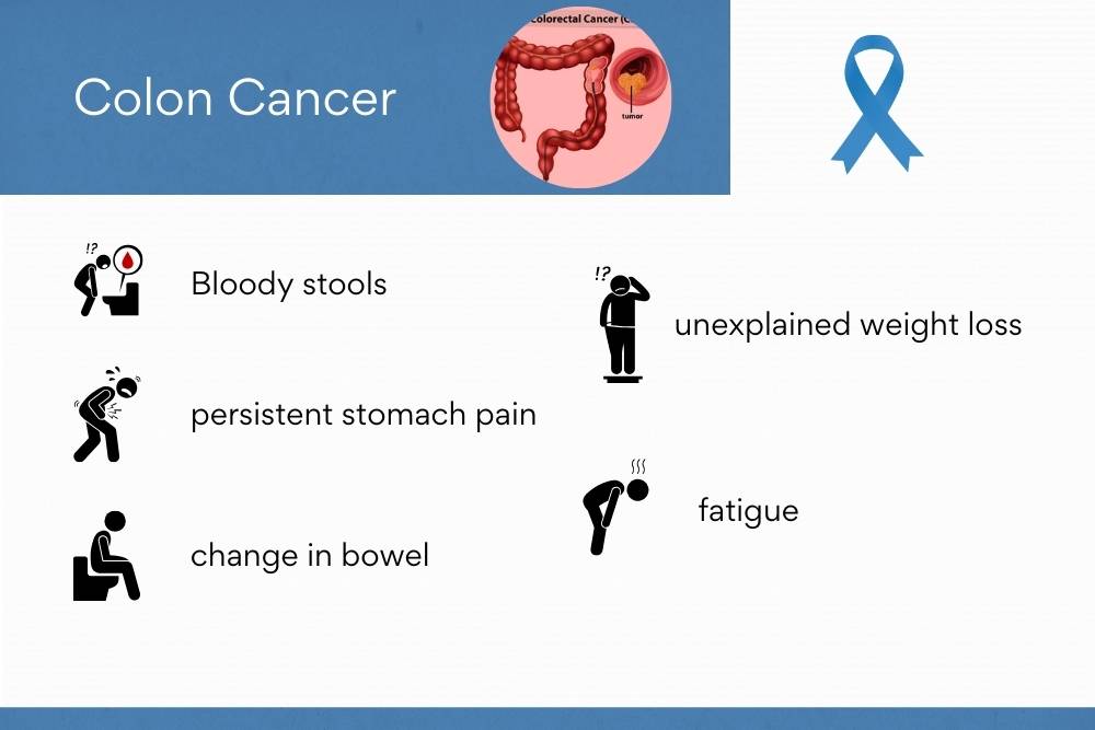 Colon Cancer