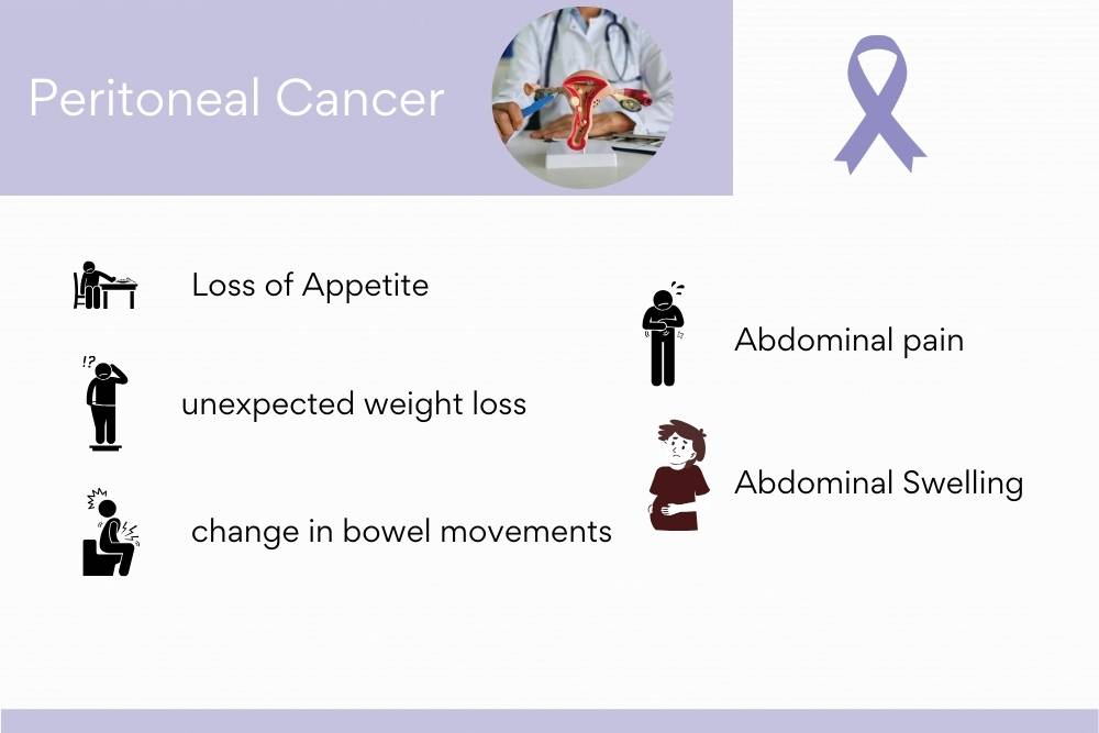 Peritoneal Cancer Treatment