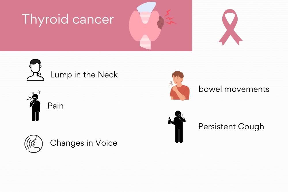 Thyroid Cancer