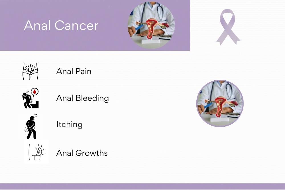 Anal Cancer