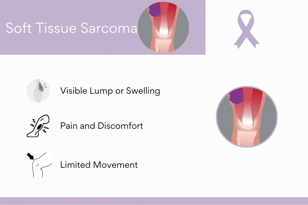 Soft Tissue Sarcoma